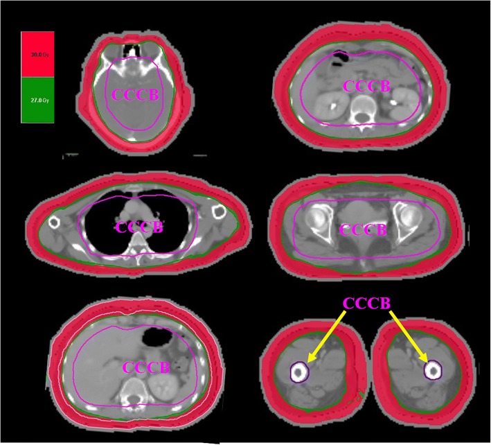 Fig. 2