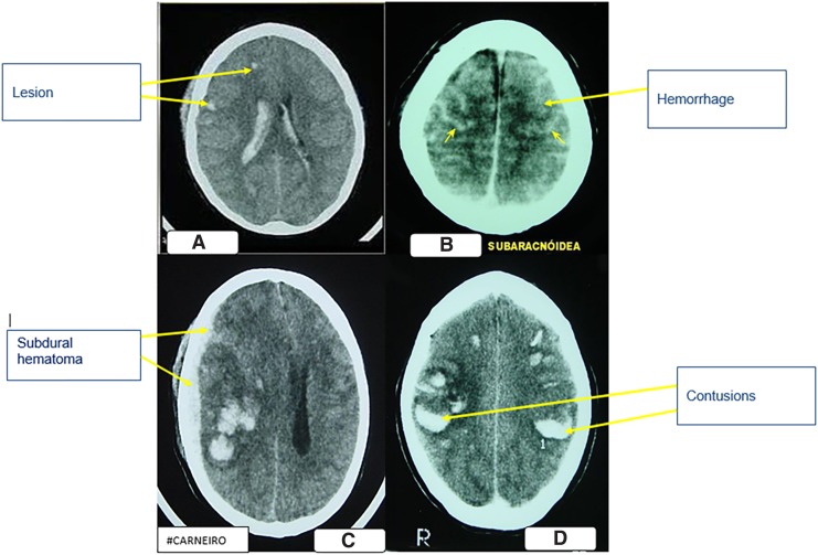 FIG. 2.