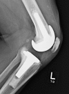 Fig. 5-B