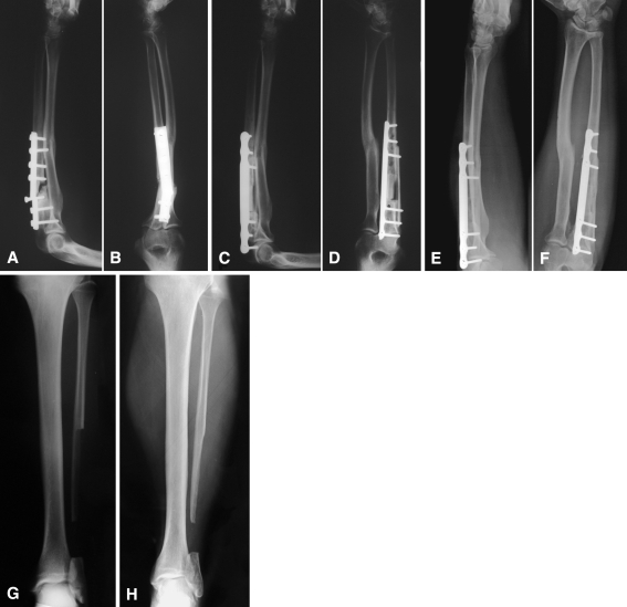 Fig. 3A–H