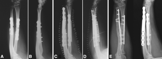 Fig. 4A–E