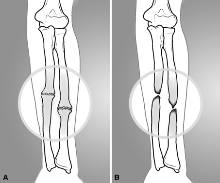 Fig. 1A–B