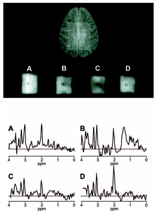 Fig 4