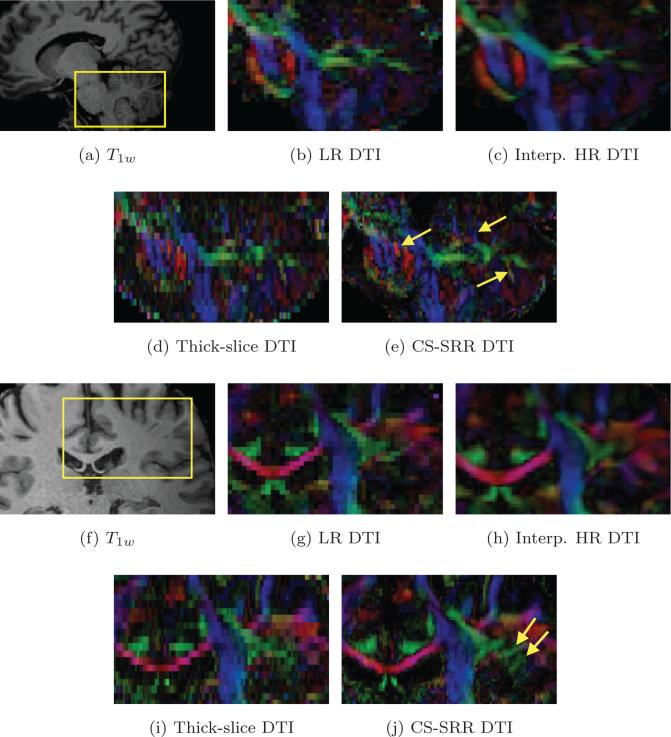 Figure 12