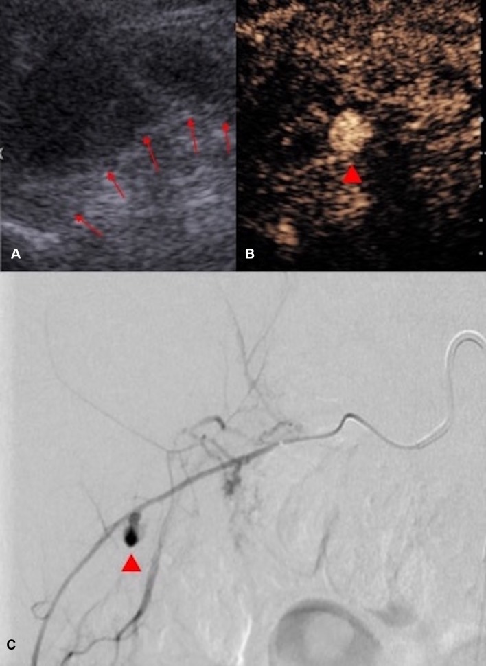 Fig. 16