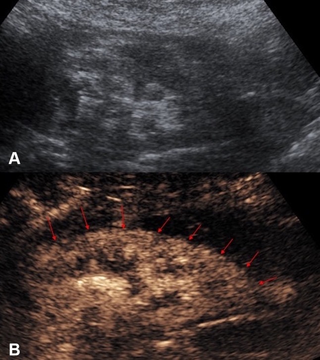 Fig. 6