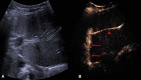 Fig. 10