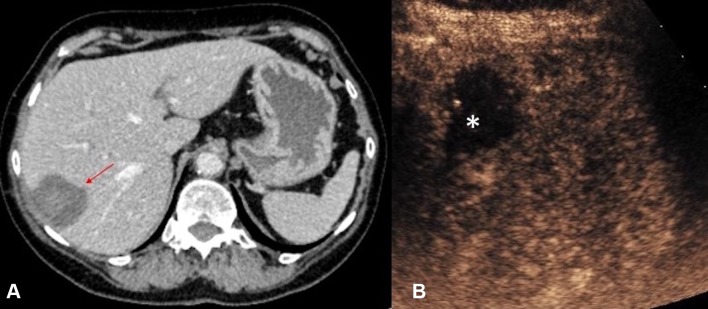 Fig. 12