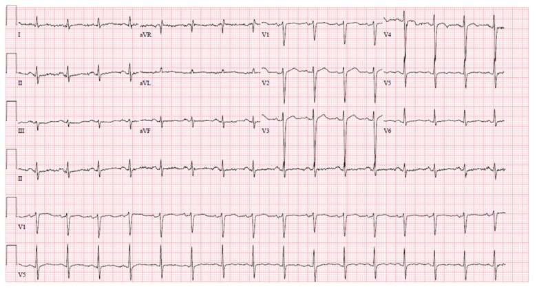 Figure 2.