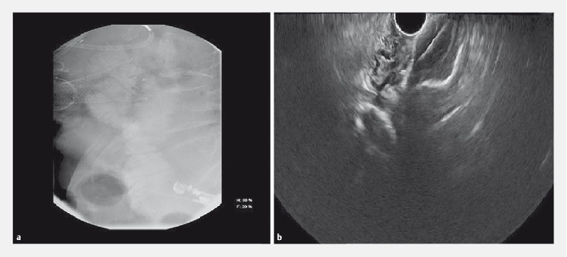 Fig. 2 a