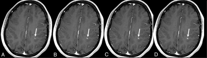 Fig 2.