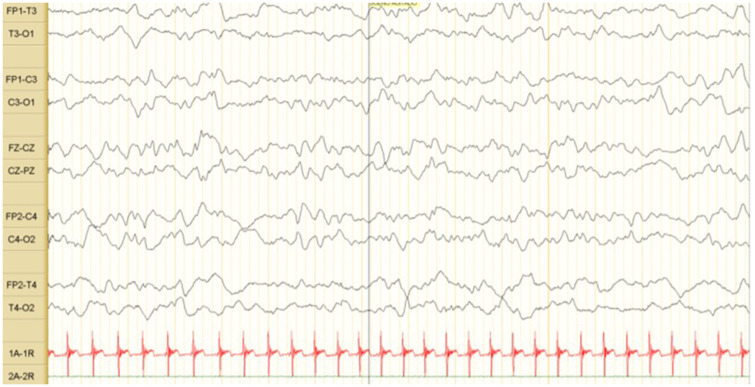 Fig. 2.