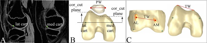 Fig. 1 A-C