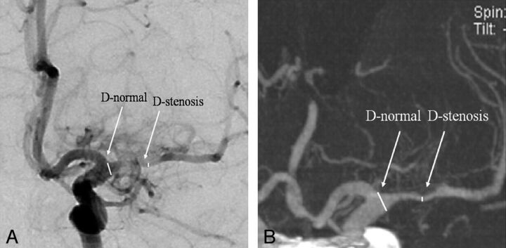 Fig 3.