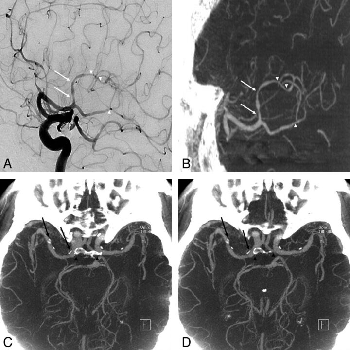 Fig 2.