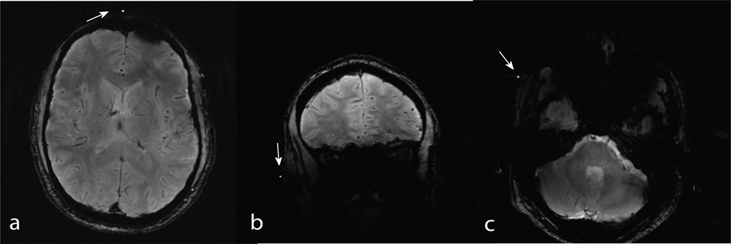 Fig 10