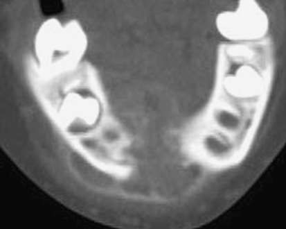 Fig. 5
