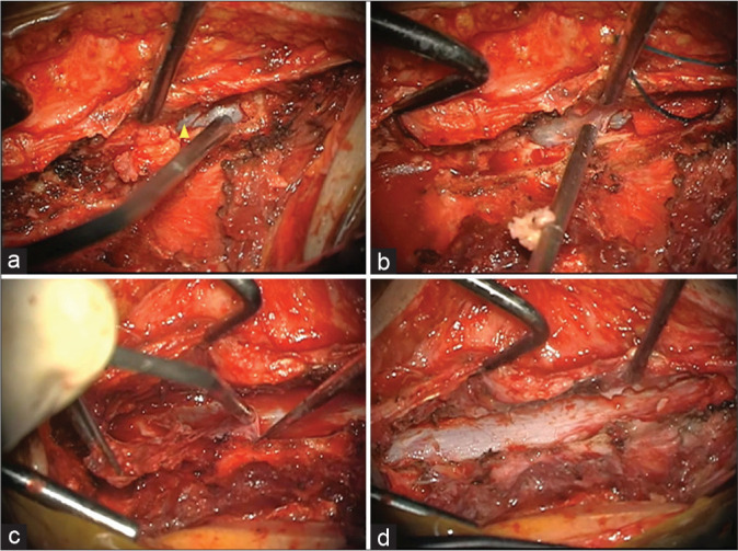 Figure 2: