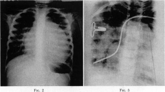 Fig. 2., Fig. 3.