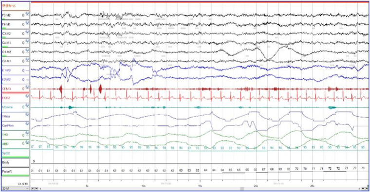 FIGURE 1