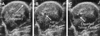 Fig. 20