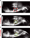 Fig. 19
