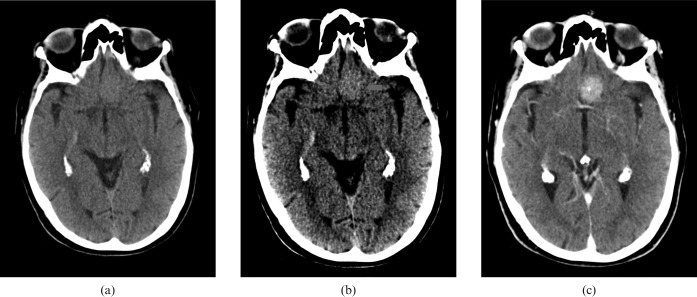 Figure 10