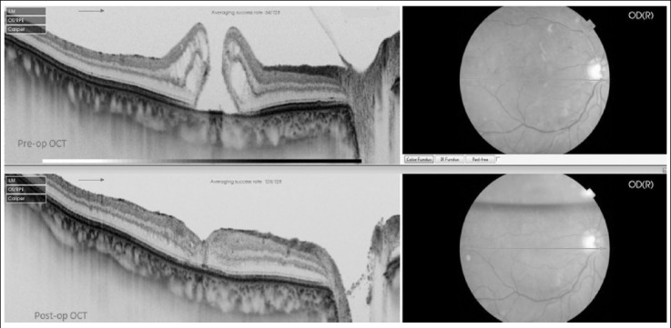 Fig.1