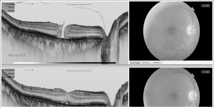 Fig.2