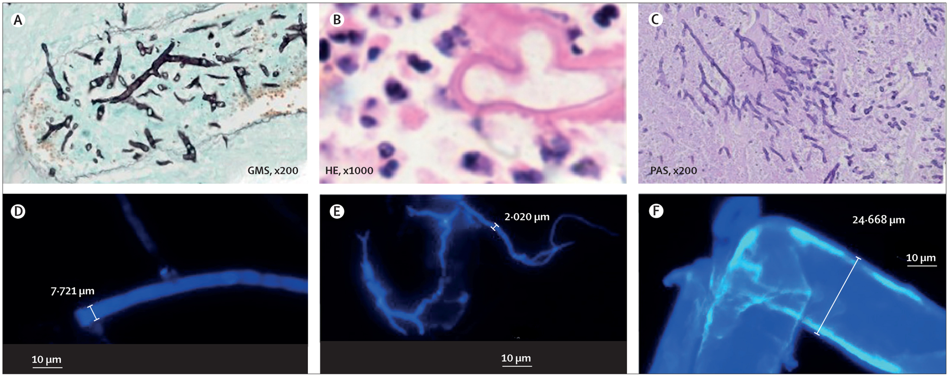 Figure 4: