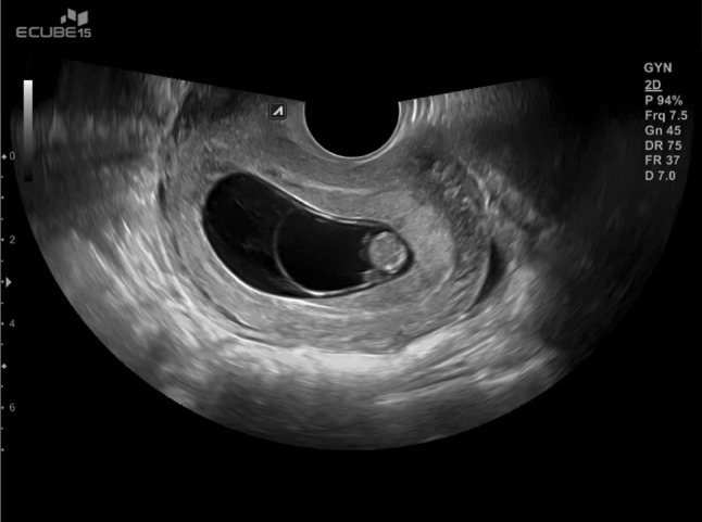 Fig. 3