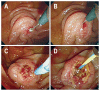 Fig. 2