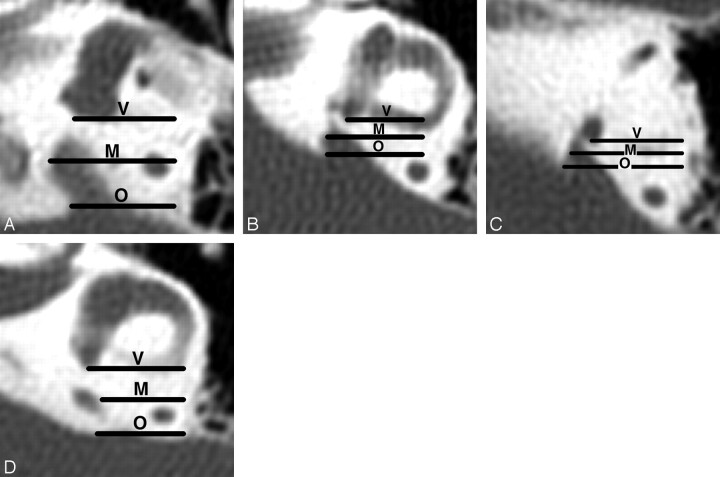 Fig 1.