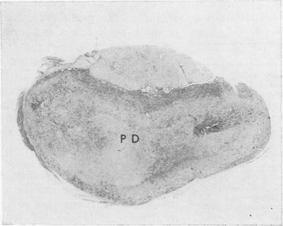 Fig. 11