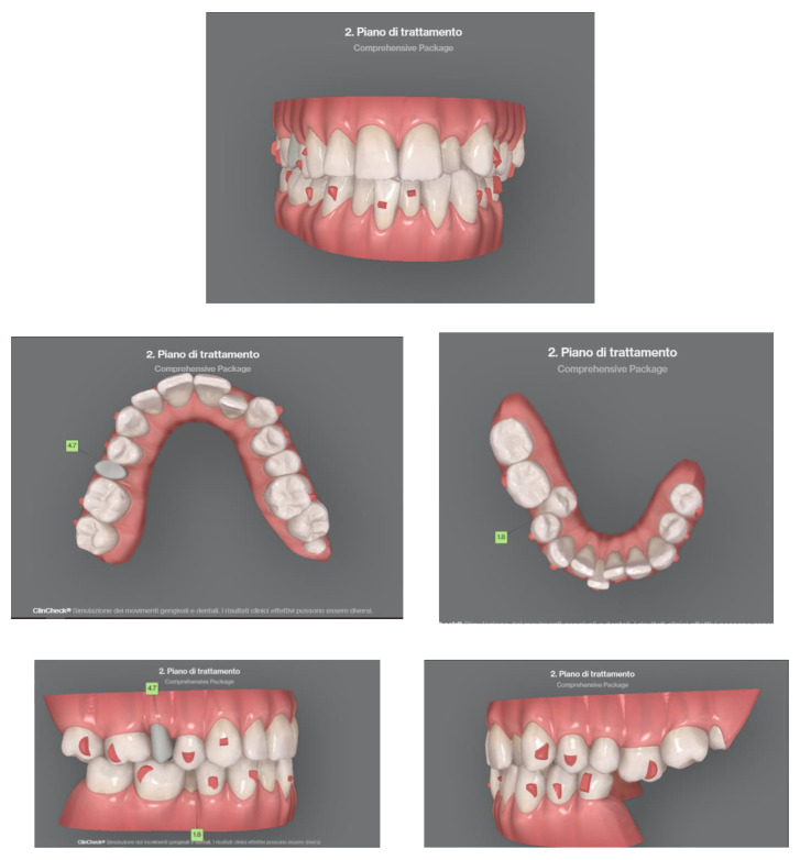 Figure 10