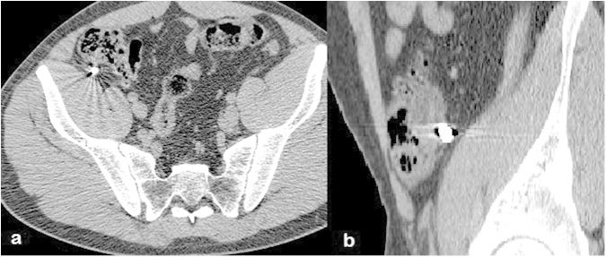 Fig. 4