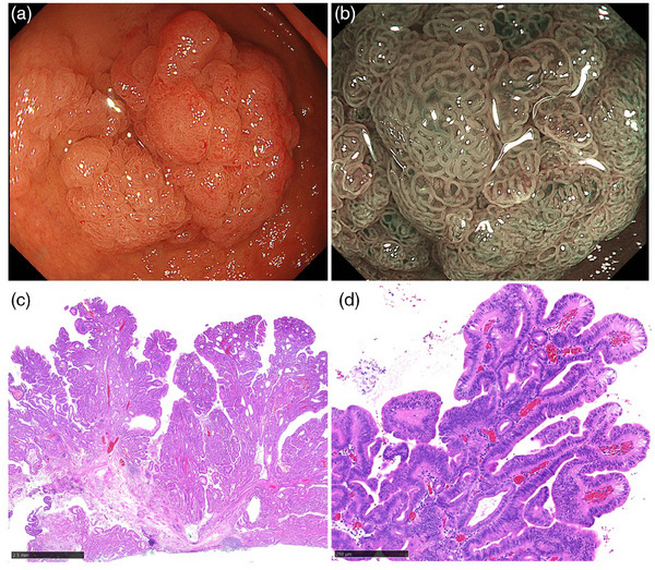 FIGURE 2