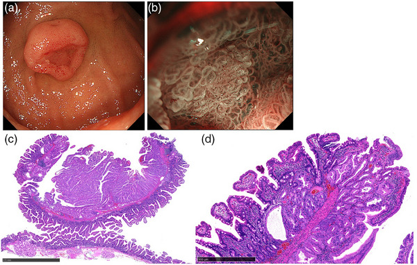 FIGURE 3