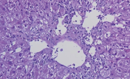 Figure 16