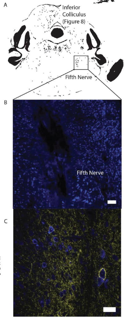 Fig. 12