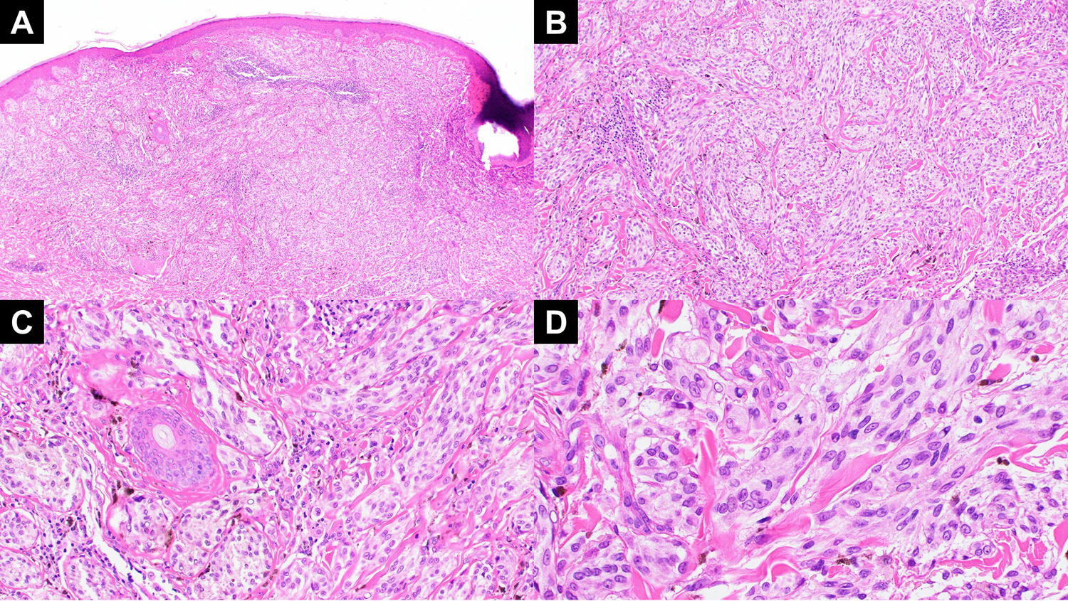 Figure 1: