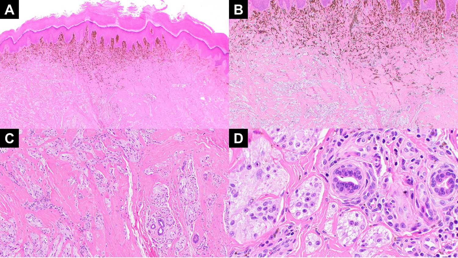 Figure 2: