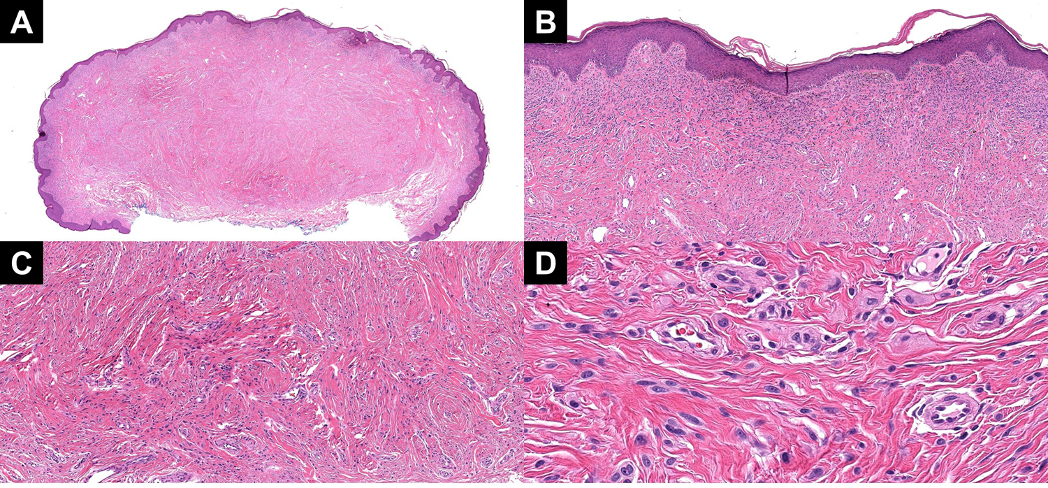 Figure 4: