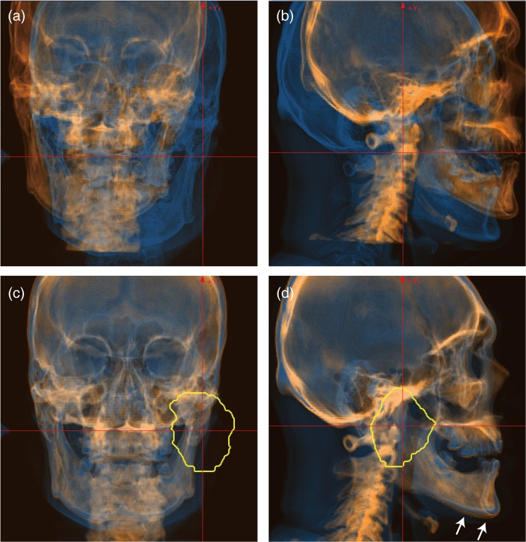 Fig. 3.