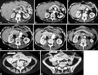 Fig. 6.