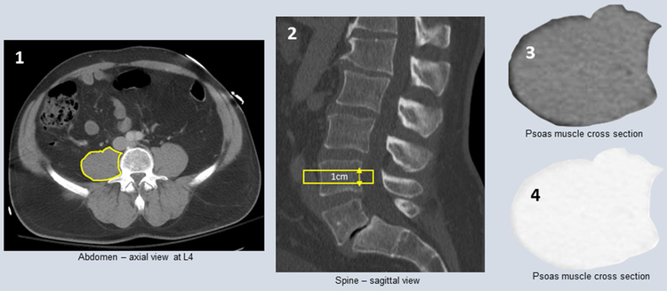 Figure 1: