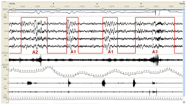 Figure 2