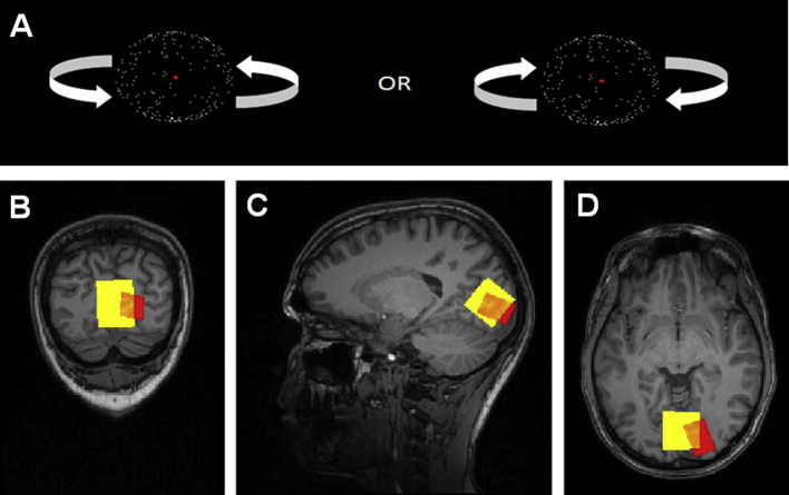 Fig. 1