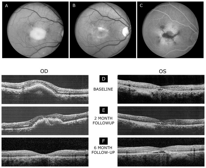 Fig.1