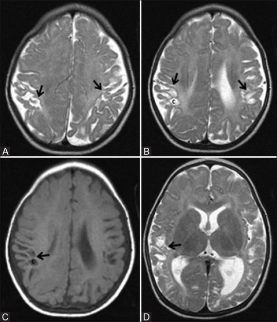 Figure 17 (A-D)